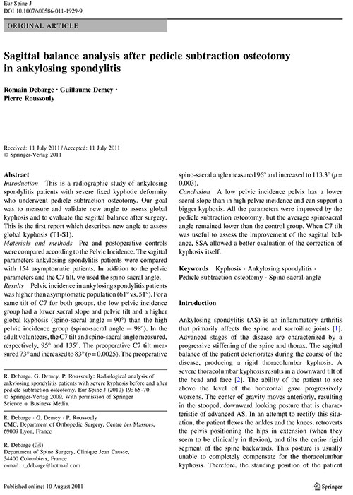 Sagittal balance analysis after pedicle subtraction osteotomy in ankylosing spondylitis