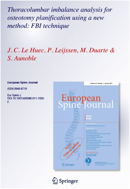 Thoracolumbar imbalance analysis for osteotomy planification using a new method: FBI technique