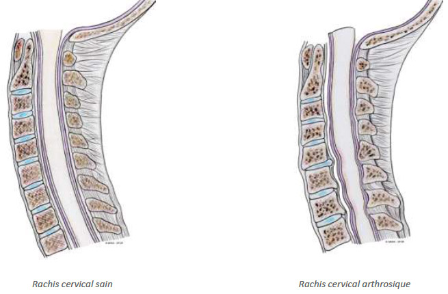 Rachis cervical